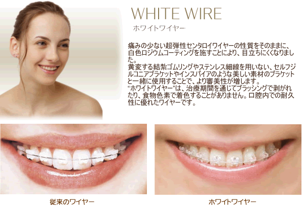 whitewire.gif